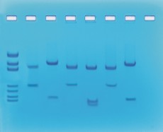 Edvotek Activity Kit - DNA Fingerprinting Using Restriction Enzymes
