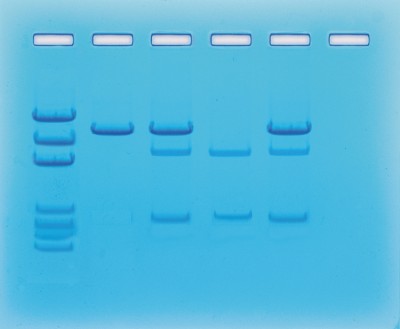 Edvotek Activity Kit - Cancer Gene Detection