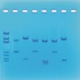 Edvotek Activity Kit - DNA Fingerprinting Using Restriction Enzymes